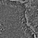 Comparison of ZCA maps on a cilia sample image with various levels of \epsilon. The original image is followed by maps with \epsilon=1\mathrm e-4, \epsilon=1\mathrm e-5, \epsilon=1\mathrm e-6, and \epsilon=1\mathrm e-7, from left to right.