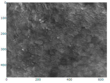 A sample frame from the cilia dataset