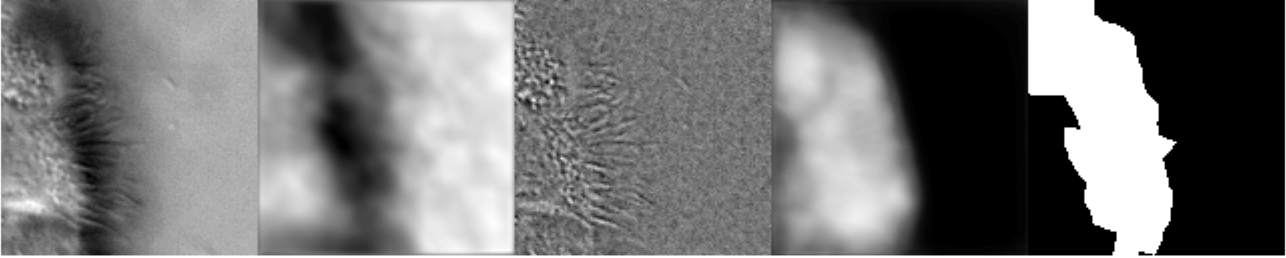 Artifacts generated 10 epochs into the training of the
composite U-Net. From left to right: original image, ZCA-mapped
image, SAE-mapped image, generated segmentation mask (pre-threshold),
ground-truth segmentation mask