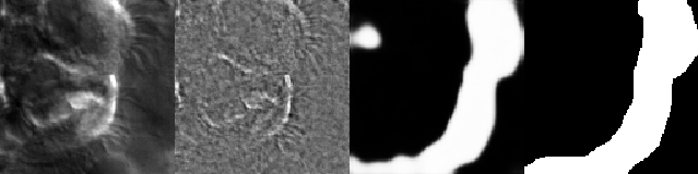 Artifacts generated during the training of ZCA+U-Net. From left
to right: original image, ZCA-mapped image, generated segmentation
mask (pre-threshold), ground-truth segmentation mask