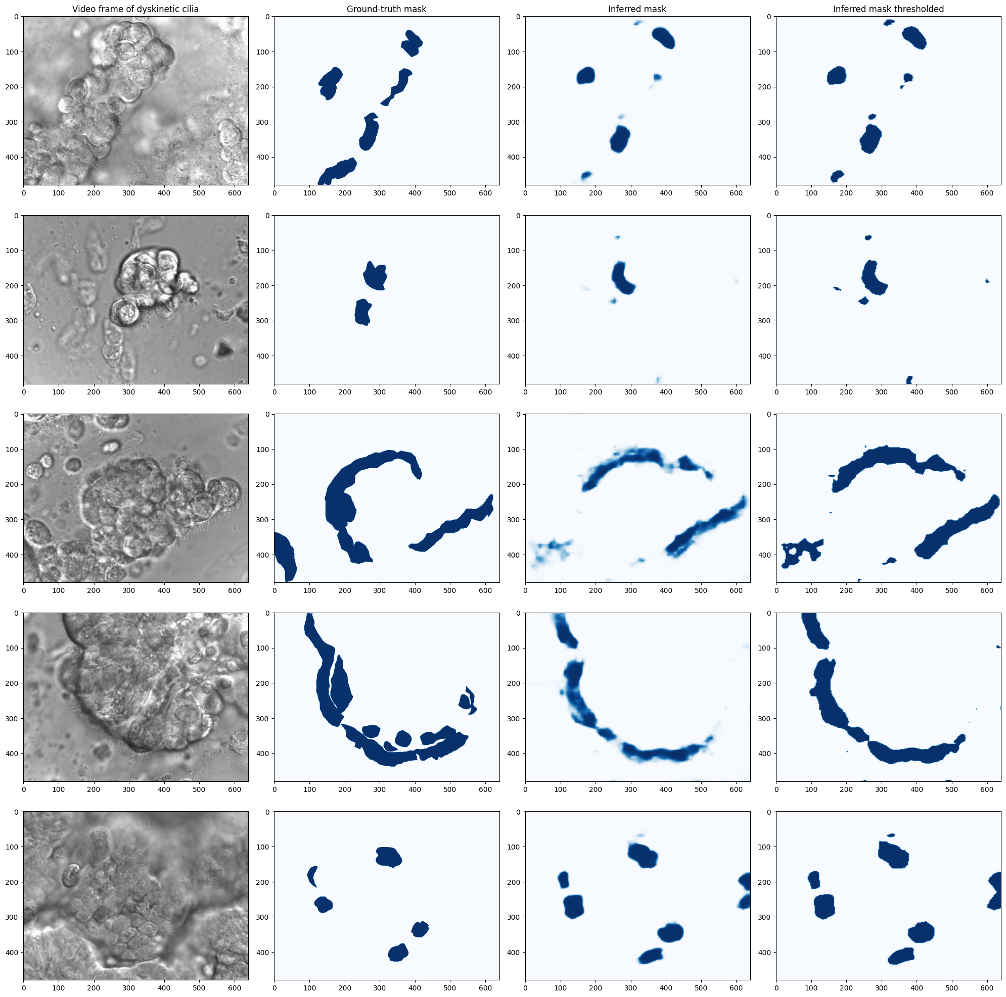 The model predictions on 5 dyskinetic cilia samples. The first column shows a frame of the video, the second column shows the manually labeled ground truth, the third column is the model’s prediction, and the last column is a thresholded version of the prediction.