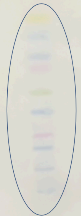 Protein Bands on Nitrocellulose Paper that Ran Properly