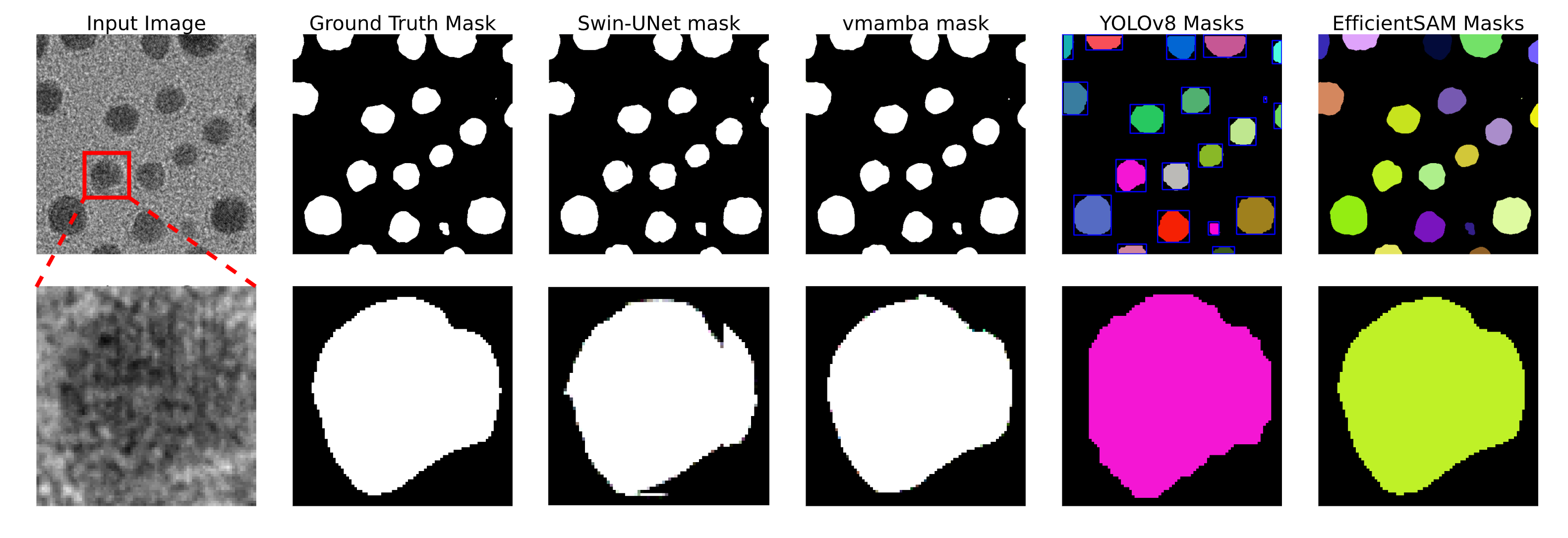 Deep Learning Applications in Microscopy: Segmentation and Tracking ...