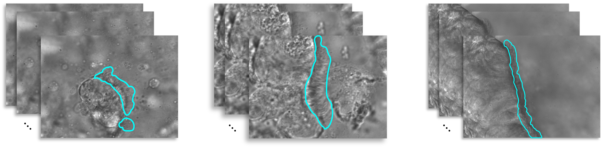 A sample of three videos in our cilia dataset with their manually annotated ground truth masks.