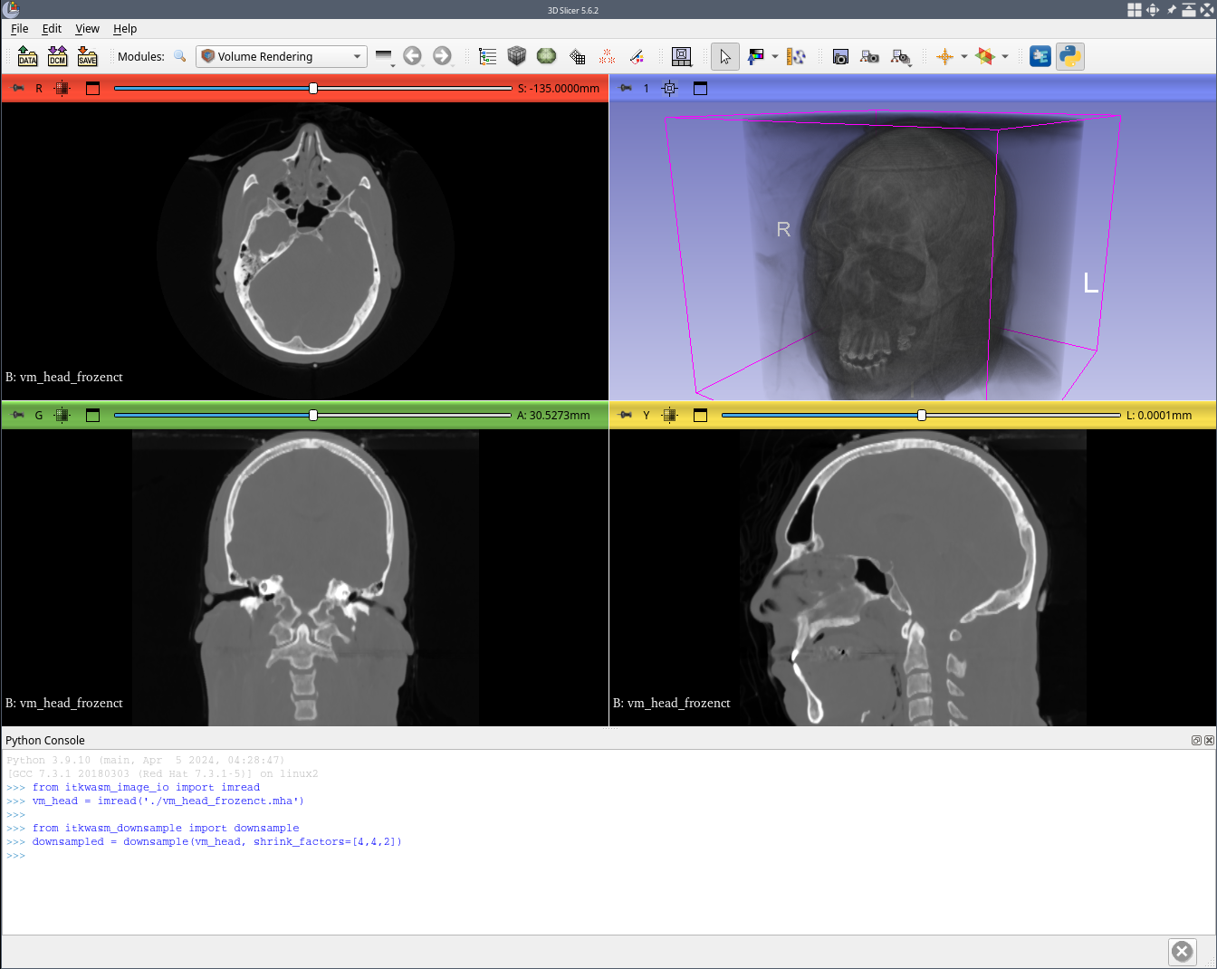 The itkwasm-downsample Python package in a traditional native desktop application, 3D Slicer.