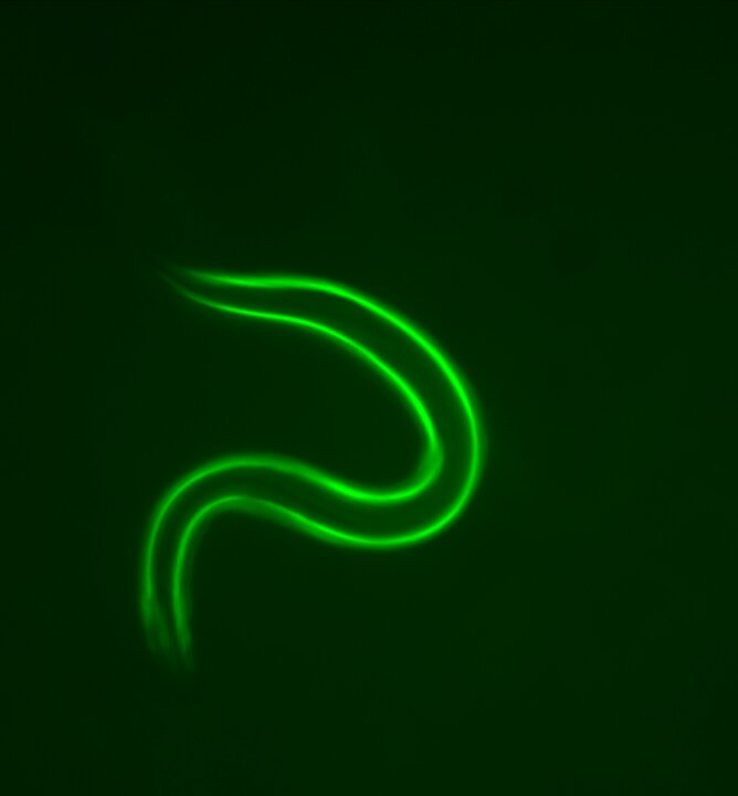 Untreated nematode (did not receive probiotic treatment) imaged with fluorescence microscopy and INFINITY ANALYZE X software.