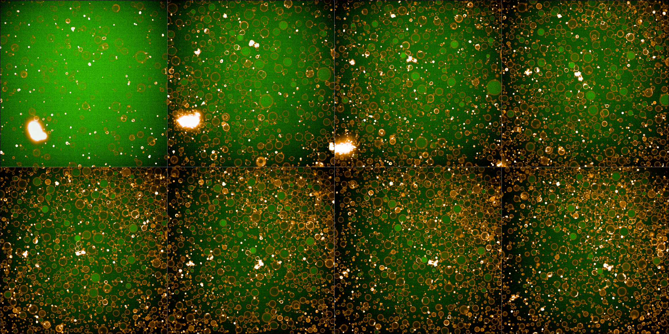 Combined green (488) and red (561) fluroescence channels.