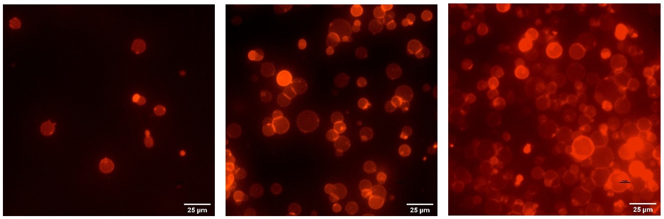 Representative images of vesicles prepared using Optiprep (left), 200 mM Sucrose (middle), and 400 mM Sucrose (right). Highest yield of GUVs occurred using an inner solution containing 400 mM Sucrose.
