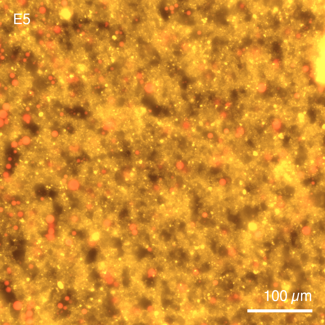 CPRG-loaded vesicles co-incubated with PLA1-expressing synthetic cells at pH 6.3 after 13 h at 37 °C. Cy5 signal is detected only in the PLA1-expressing synthetic cells. The fraction of vesicles retaining Cy5 is markedly reduced compared with E4, indicating PLA1-mediated Cy5 release.